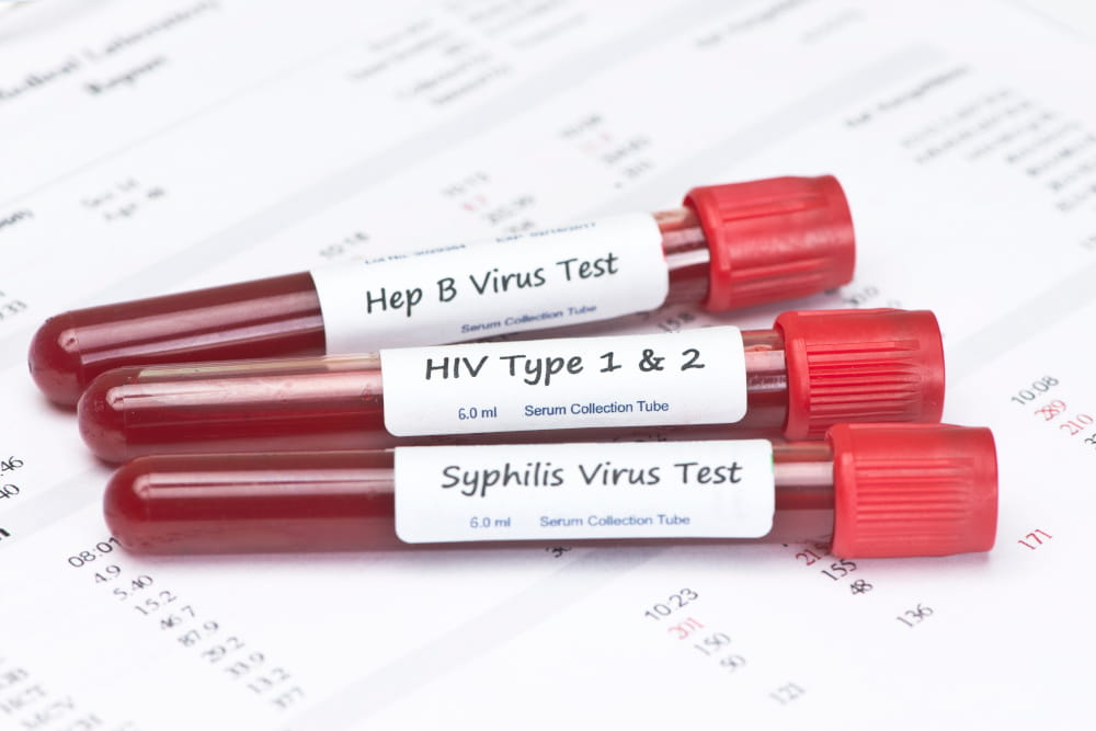 Bluttests für drei sexuell übertragbare Krankheiten: HIV, Hepatitis B, Syphilis. Diese können im Gesundheitsamt Frankfurt bei der Untersuchungs- und Beratungsstelle für sexuelle und reproduktive Gesundheit durchgeführt werden.